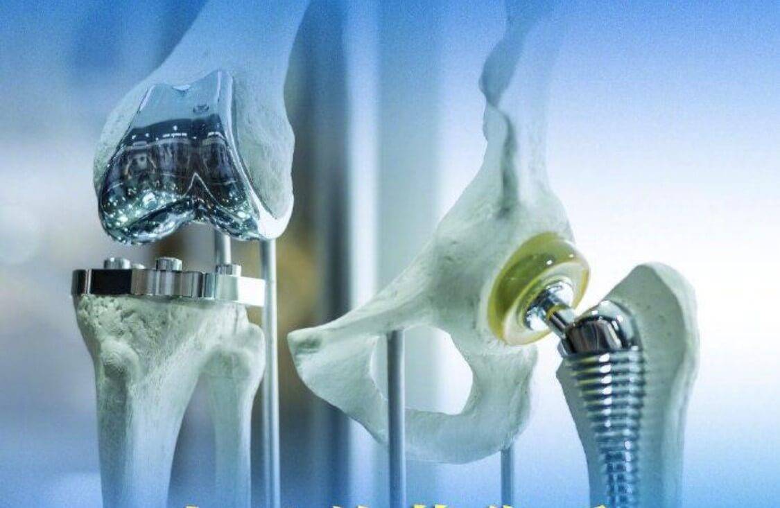 surface processing technologies for orthopedic instruments and implants